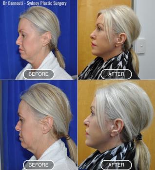 Image for Sydney Plastic Surgery with ID of: 6746442