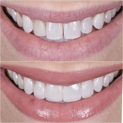 Image for Murphey Dental Aesthetics with ID of: 6751517