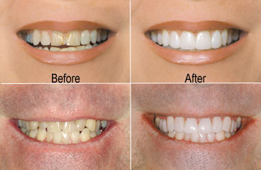 Image for Excel Dental Office San Marcos CA with ID of: 691438
