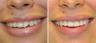 Image for Emergency Dentist NYC with ID of: 692532