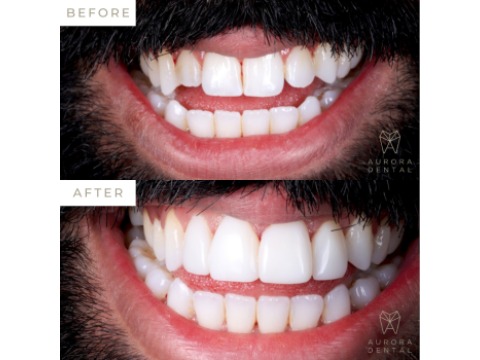 Image for Aurora Dental Solihull with ID of: 6824227
