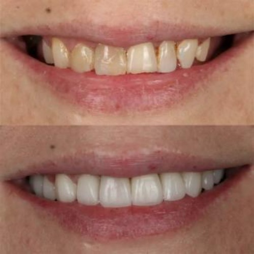 Image for DC Dental Legacy with ID of: 6837747