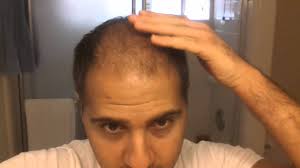 Image for Modena Hair Transplant Clinic with ID of: 694514