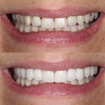 Image for LALUME Dental Studio with ID of: 6859660