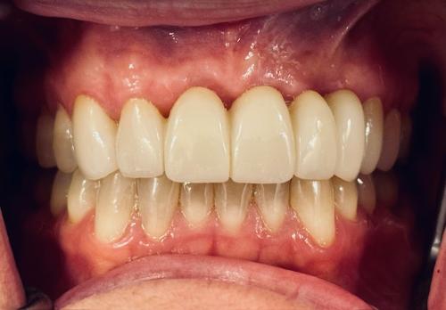 Image for Nova Premier Dental with ID of: 6866069