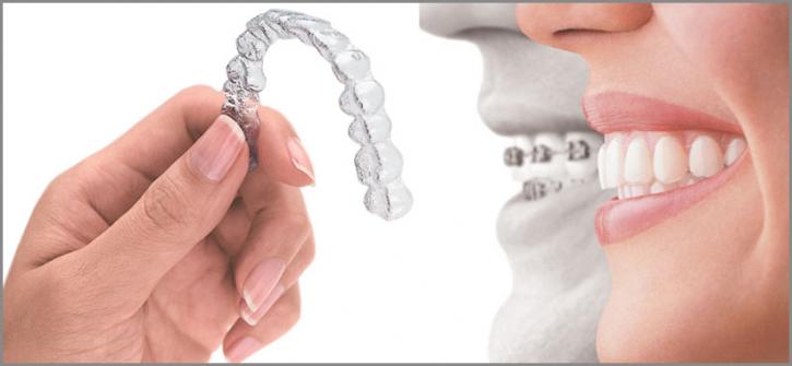 Image for Manhattan Invisalign with ID of: 696860