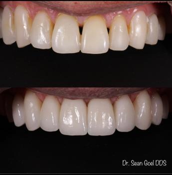 Image for Schnierow Dental Care with ID of: 6890719