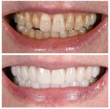Image for Minot Dental Partners with ID of: 6914708