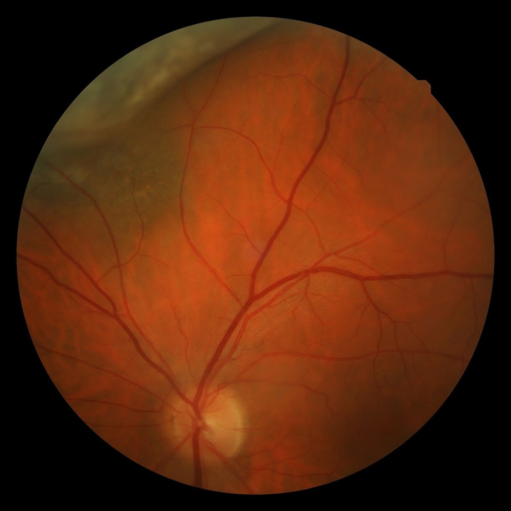 Image for Vaske Vision Care with ID of: 6932689