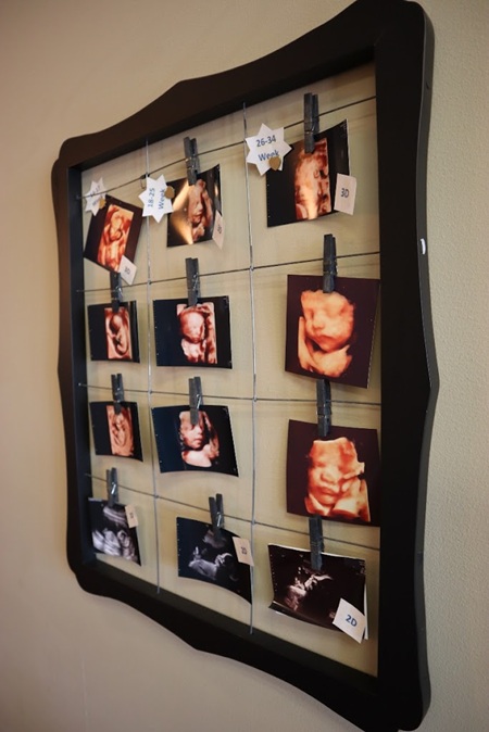 Image for Keepsake Baby Ultrasound with ID of: 6940275