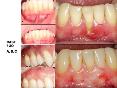 Image for IMPrESS Perio Implant Center| Certified Specialists with ID of: 6960012