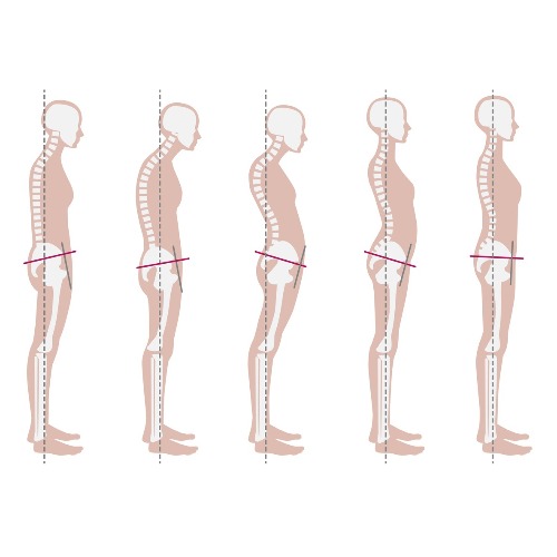 Image for Rolfing Insight with ID of: 6993853