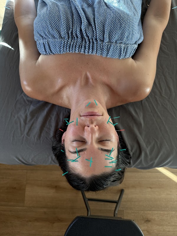 Image for California Mobile Acupuncture with ID of: 7006099