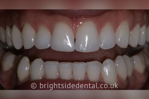 Image for Brightside Dental with ID of: 7012999