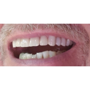 Image for Wojtowicz Dental with ID of: 7021763