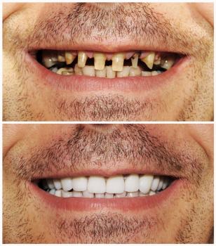 Image for TruSmile Now with ID of: 7049435