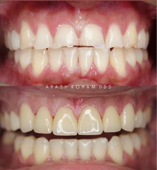 Image for Healthy Smiles La Crescenta with ID of: 7097246