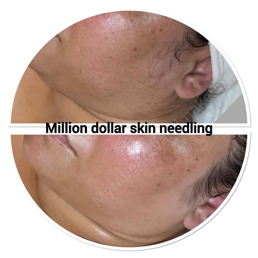 Image for MyraGlowLab with ID of: 7152981