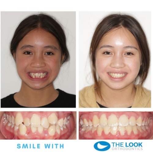 Image for The Look Orthodontists with ID of: 7190175