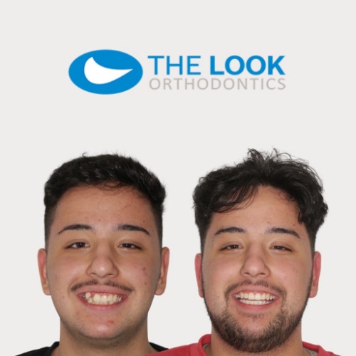 Image for The Look Orthodontists with ID of: 7190307