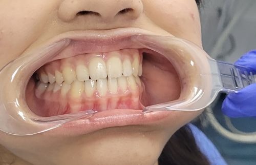 Image for The Look Orthodontists with ID of: 7190440