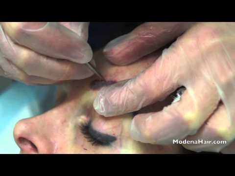 Image for Modena Hair Transplant Clinic with ID of: 713050