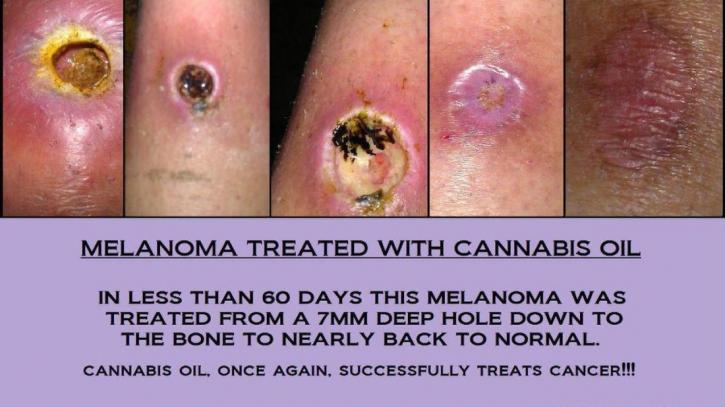 Image for Cancer Cures made Illegal with ID of: 713185