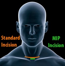 Image for The CENTER for Advanced Parathyroid Surgery with ID of: 713992