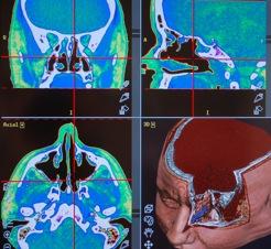 Image for The CENTER for Advanced Parathyroid Surgery with ID of: 713994