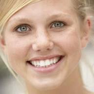 Image for Porcelain Veneers with ID of: 714647