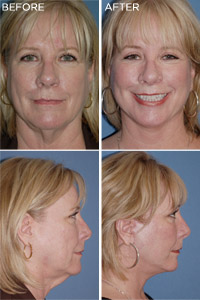 Image for Alexander Cosmetic Surgery with ID of: 717764