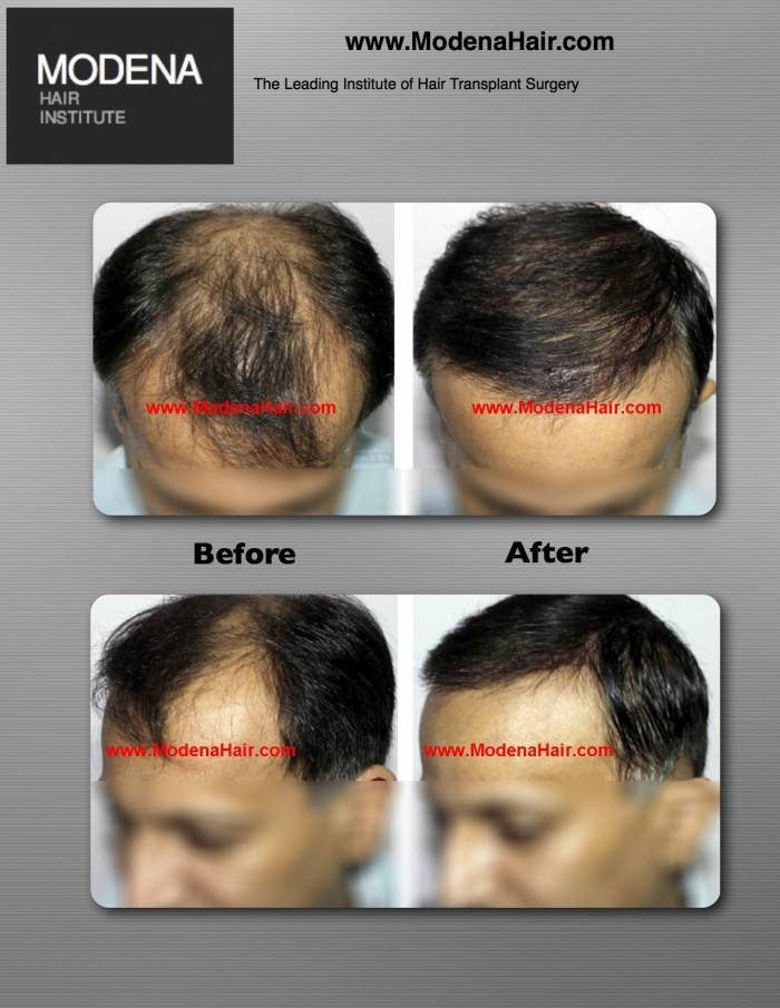 Image for Modena Hair Transplant Clinic with ID of: 722697
