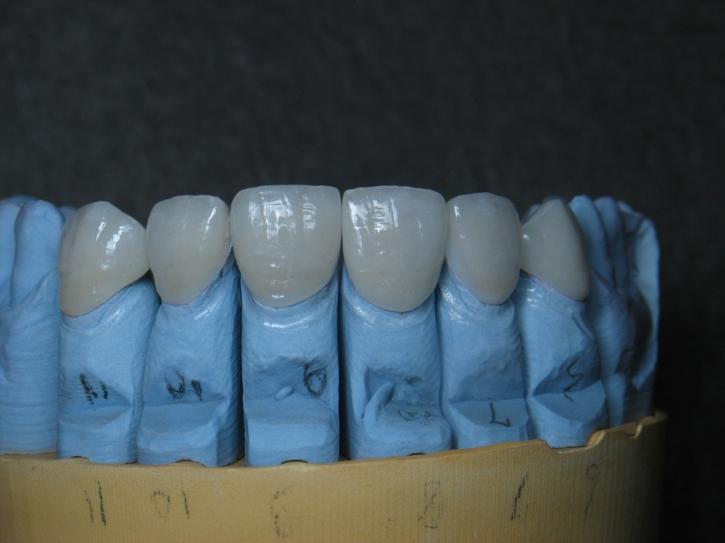 Image for Idol Dental Lab with ID of: 742427