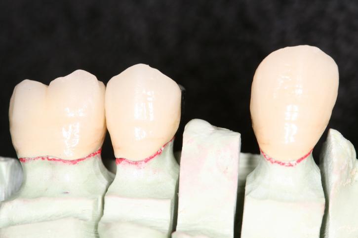 Image for Idol Dental Lab with ID of: 742430
