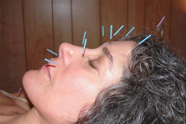 Image for Thrive Acupuncture, PLLC with ID of: 747865