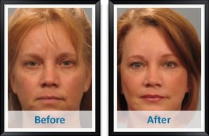 Image for Atlanta Plastic & Reconstructive Specialists with ID of: 752223
