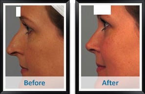 Image for Atlanta Plastic & Reconstructive Specialists with ID of: 752226