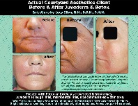 Image for Courtyard Aesthetics with ID of: 752768