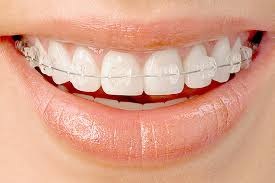 Image for Nejat Orthodontics with ID of: 797826