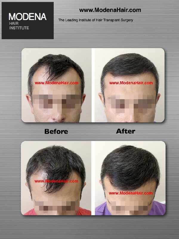 Image for Modena Hair Transplant Clinic with ID of: 798248