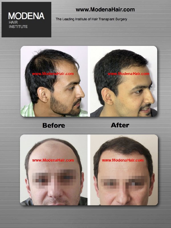 Image for Modena Hair Transplant Clinic with ID of: 798251