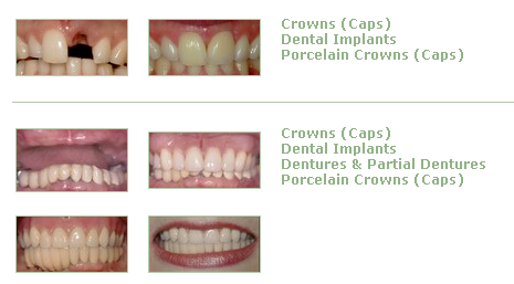 Image for Expert Dentist in Schaumburg - Hoffmansmiles with ID of: 803751