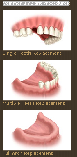 Image for Expert Dentist in Schaumburg - Hoffmansmiles with ID of: 803754