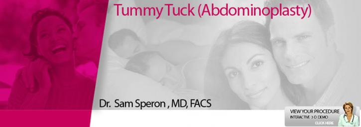 Image for Chicago Tummy Tuck with ID of: 835144