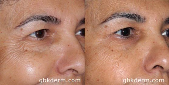 Image for San Diego Botox San Diego with ID of: 839186