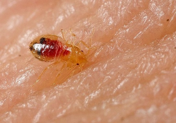 Image for bed bugs with ID of: 848343