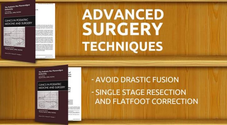 Image for Tarsal Coalition Surgery with ID of: 848867