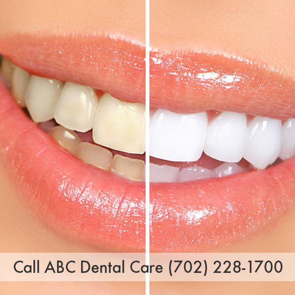 Image for ABC Dental Care with ID of: 866739