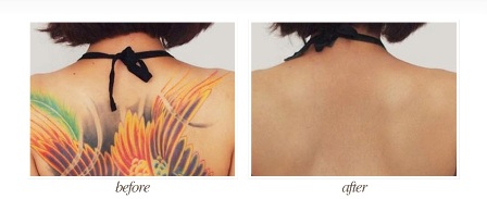 Image for Microskin with ID of: 868265