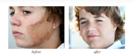 Image for Microskin with ID of: 868272